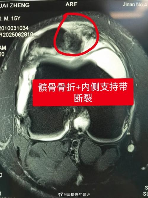 官方：杰登麦克丹尼尔斯遭左膝髌腱炎&骨头挫伤被列入每周观察